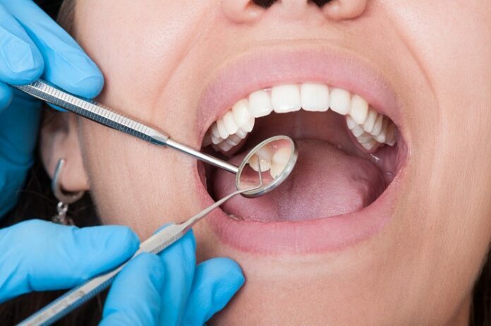Dental Issues by Visiting Boulder Dentist