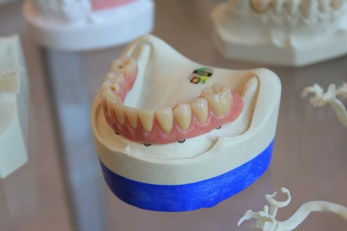 Teeth Glitches